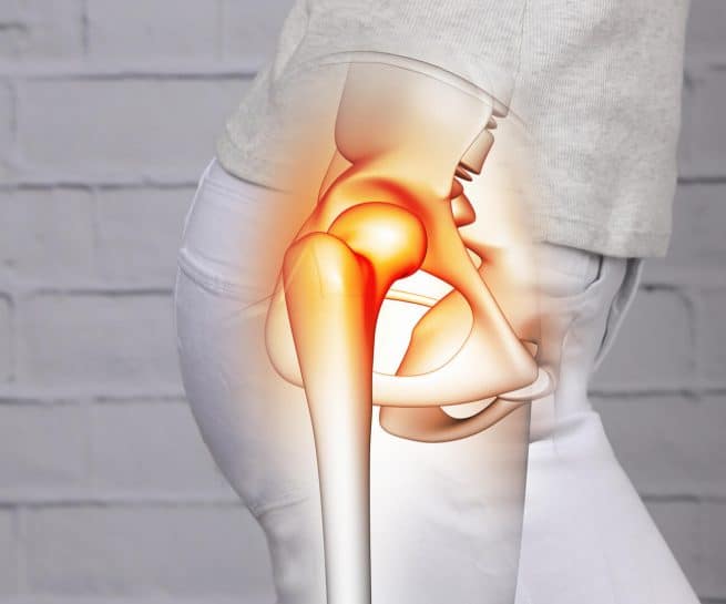 woman with painful hip