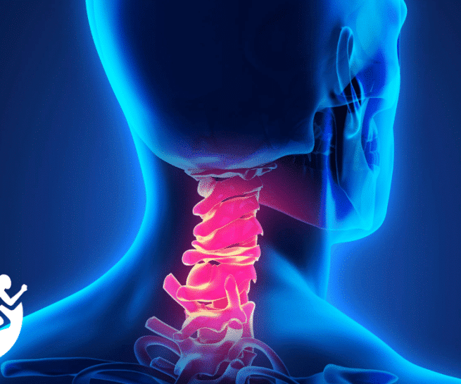 Image of a patent having radiating pain in the neck being treated medical illustration from orthoedge in Jacksonville Florida